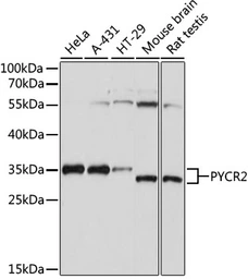 Anti-PYCR2 antibody used in Western Blot (WB). GTX66340