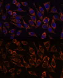 Anti-PYCR2 antibody used in Immunocytochemistry/ Immunofluorescence (ICC/IF). GTX66340