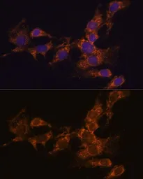 Anti-PYCR2 antibody used in Immunocytochemistry/ Immunofluorescence (ICC/IF). GTX66340