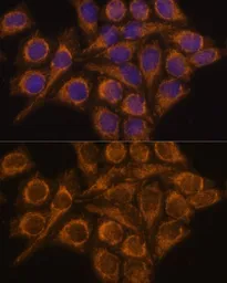 Anti-PYCR2 antibody used in Immunocytochemistry/ Immunofluorescence (ICC/IF). GTX66340