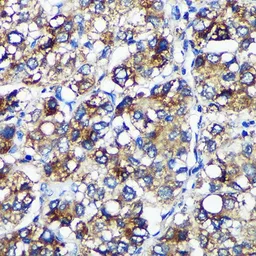 Anti-PYCR2 antibody used in IHC (Paraffin sections) (IHC-P). GTX66340