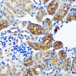 Anti-PYCR2 antibody used in IHC (Paraffin sections) (IHC-P). GTX66340