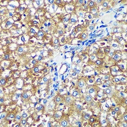 Anti-PYCR2 antibody used in IHC (Paraffin sections) (IHC-P). GTX66340