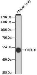 Anti-CRELD1 antibody used in Western Blot (WB). GTX66342