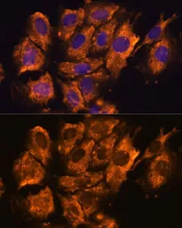 Anti-CRELD1 antibody used in Immunocytochemistry/ Immunofluorescence (ICC/IF). GTX66342
