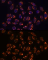 Anti-CRELD1 antibody used in Immunocytochemistry/ Immunofluorescence (ICC/IF). GTX66342