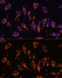 Anti-CRELD1 antibody used in Immunocytochemistry/ Immunofluorescence (ICC/IF). GTX66342