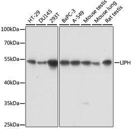 Anti-LIPH antibody used in Western Blot (WB). GTX66344