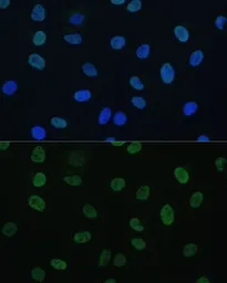 Anti-GTF2E1 antibody used in Immunocytochemistry/ Immunofluorescence (ICC/IF). GTX66351