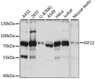 Anti-KIF22 antibody used in Western Blot (WB). GTX66353