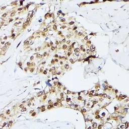 Anti-KIF22 antibody used in IHC (Paraffin sections) (IHC-P). GTX66353