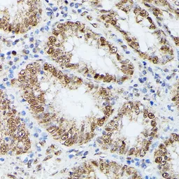 Anti-KIF22 antibody used in IHC (Paraffin sections) (IHC-P). GTX66353