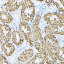 Anti-PLS1 antibody used in IHC (Paraffin sections) (IHC-P). GTX66355