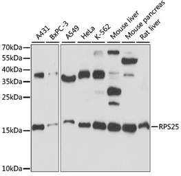Anti-RPS25 antibody used in Western Blot (WB). GTX66357