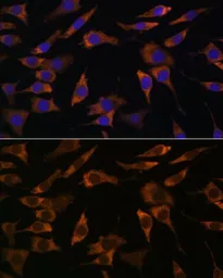 Anti-RPS25 antibody used in Immunocytochemistry/ Immunofluorescence (ICC/IF). GTX66357