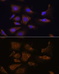 Anti-RPS25 antibody used in Immunocytochemistry/ Immunofluorescence (ICC/IF). GTX66357