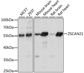 Anti-ZNF38 antibody used in Western Blot (WB). GTX66359