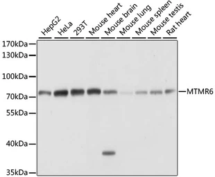 Anti-MTMR6 antibody used in Western Blot (WB). GTX66362