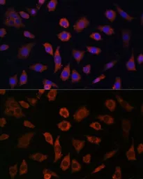 Anti-Cytohesin 1 antibody used in Immunocytochemistry/ Immunofluorescence (ICC/IF). GTX66363