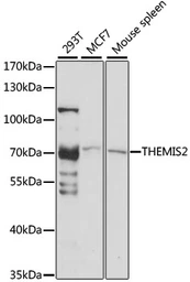 Anti-ICB1 antibody used in Western Blot (WB). GTX66365