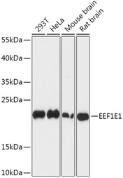 Anti-EEF1E1 antibody used in Western Blot (WB). GTX66367