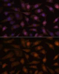 Anti-EEF1E1 antibody used in Immunocytochemistry/ Immunofluorescence (ICC/IF). GTX66367