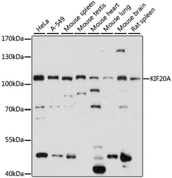 Anti-KIF20A antibody used in Western Blot (WB). GTX66371