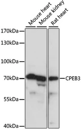 Anti-CPEB3 antibody used in Western Blot (WB). GTX66374
