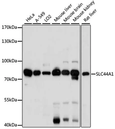 Anti-CD92 antibody used in Western Blot (WB). GTX66376