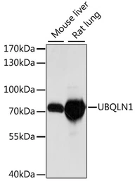 Anti-Ubiquilin 1 antibody used in Western Blot (WB). GTX66380