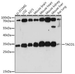 Anti-CCDC44 antibody used in Western Blot (WB). GTX66382