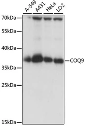 Anti-COQ9 antibody used in Western Blot (WB). GTX66385