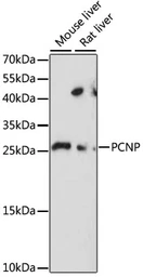 Anti-PCNP antibody used in Western Blot (WB). GTX66386
