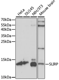 Anti-SLIRP antibody used in Western Blot (WB). GTX66390
