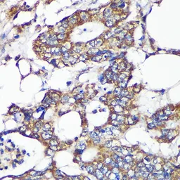 Anti-SLIRP antibody used in IHC (Paraffin sections) (IHC-P). GTX66390