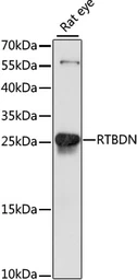 Anti-RTBDN antibody used in Western Blot (WB). GTX66391