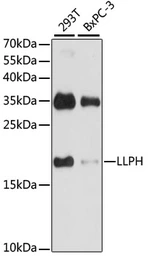 Anti-LLPH antibody used in Western Blot (WB). GTX66393