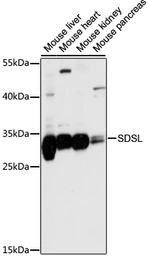 Anti-SDSL antibody used in Western Blot (WB). GTX66395