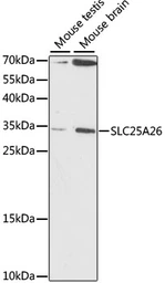 Anti-SLC25A26 antibody used in Western Blot (WB). GTX66396