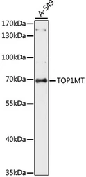 Anti-TOP1MT antibody used in Western Blot (WB). GTX66397