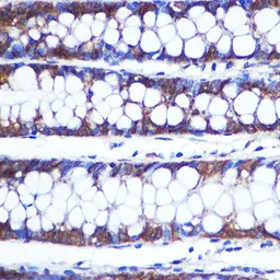 Anti-TOP1MT antibody used in IHC (Paraffin sections) (IHC-P). GTX66397