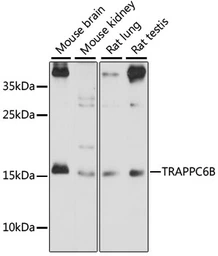 Anti-TRAPPC6B antibody used in Western Blot (WB). GTX66398