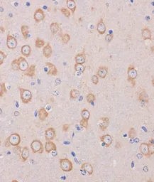 Anti-TRAPPC6B antibody used in IHC (Paraffin sections) (IHC-P). GTX66398