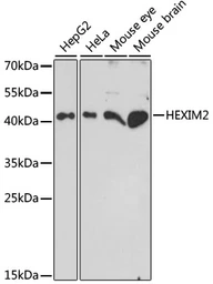 Anti-HEXIM2 antibody used in Western Blot (WB). GTX66400