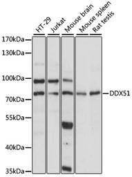Anti-DDX51 antibody used in Western Blot (WB). GTX66402