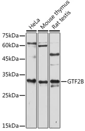 Anti-TFIIB antibody used in Western Blot (WB). GTX66408
