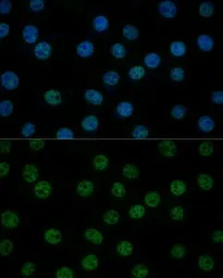 Anti-TFIIB antibody used in Immunocytochemistry/ Immunofluorescence (ICC/IF). GTX66408