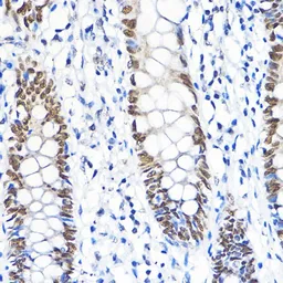Anti-TFIIB antibody used in IHC (Paraffin sections) (IHC-P). GTX66408