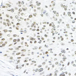 Anti-TFIIB antibody used in IHC (Paraffin sections) (IHC-P). GTX66408