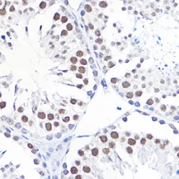 Anti-TFIIB antibody used in IHC (Paraffin sections) (IHC-P). GTX66408